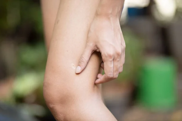 Азиатская Женщина Царапает Кожу Ноги Концепция Сухой Кожи Аллергическое Воспаление — стоковое фото