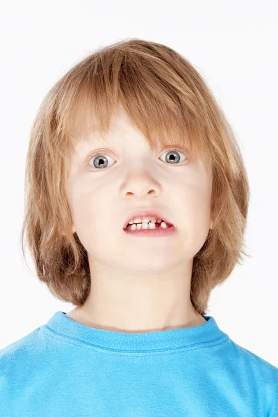 Menino com cabelo loiro mostrando seus dentes de leite desaparecidos — Fotografia de Stock
