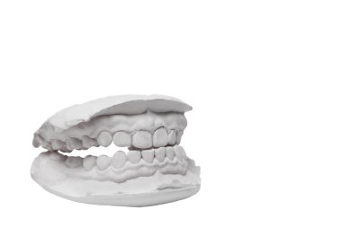 Mould of human teeth clipart