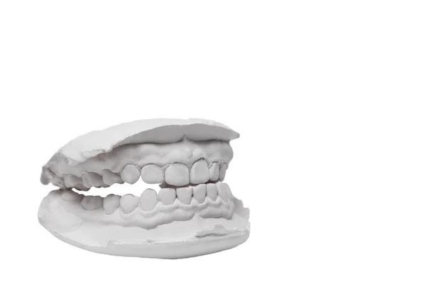 Az emberi fogak penész — Stock Fotó