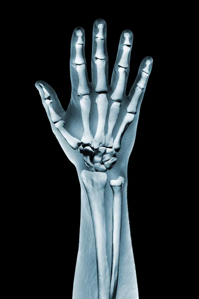 Dramatized x ray of a hand on black — Stock Photo, Image