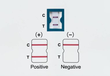 Nakhon Ratchasima, THAILAND - 10 Ekim 2021: Coronavirus (Covid-19) Lepu Medikal Teknolojisi için SARS-CoV-2 Antijen Test kitleri (atk) ile pozitif test sonuçları