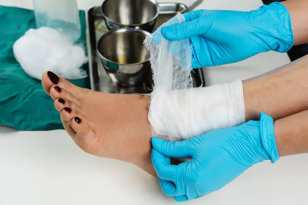 Крупним Планом Лікар Перев Язування Ноги Пацієнта Після Очищення Рани — стокове фото
