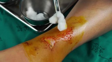 Doktor bacağındaki yarayı kapat, düşmekten yaralanma var.