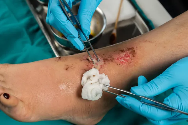 Doktor Bacağındaki Yarayı Kapat Düşmekten Yaralanma Var — Stok fotoğraf