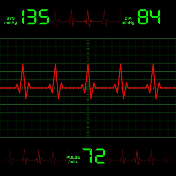 Frequenza cardiaca — Vettoriale Stock