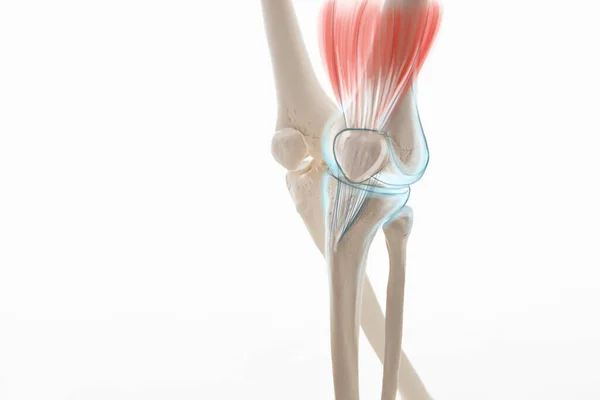 膝关节半月板腿骨痛 人体腿解剖学说明 — 图库照片
