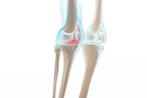 Knä Meniscus Ben Smärta Mänskligt Ben Anatomi Illustration Royaltyfria Stockfoton