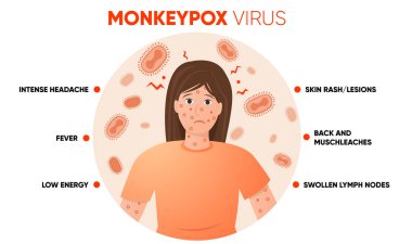 Monkeypox virus symptoms simple infographic. Poster for social media, articles and flyers. Vector illustration.