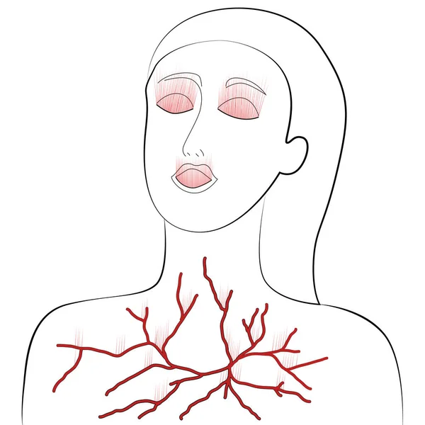 Аллергия Боль Женщине Повреждение Глаз Рта Груди Людей Буря Молния — стоковый вектор