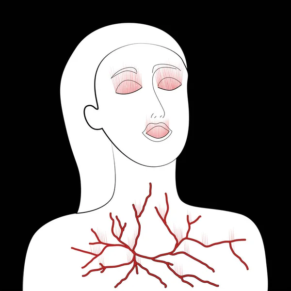 Аллергия Боль Женщине Повреждение Глаз Рта Груди Людей Буря Молния — стоковый вектор