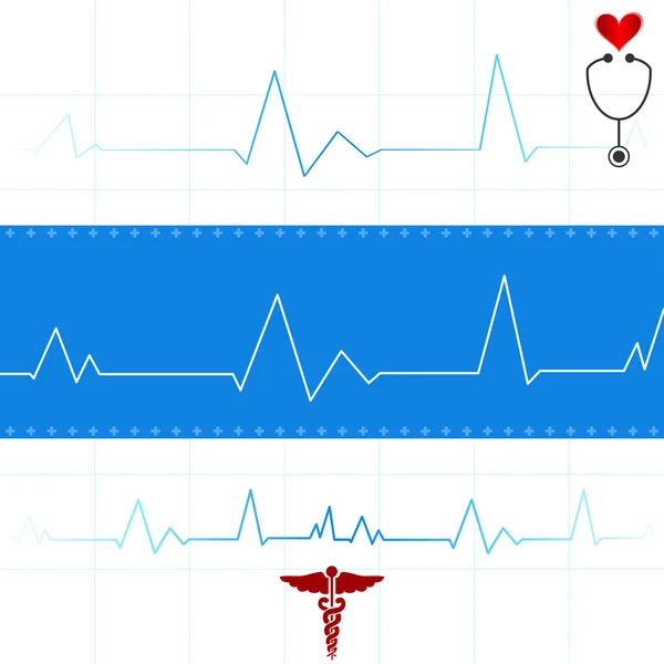 Eletrocardiograma Gráfico — Vetor de Stock