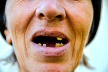 Mavi olgun böğürtlen dalında bir çalıdan yapraklar (Lonicera edulis, Loncera caerulea)