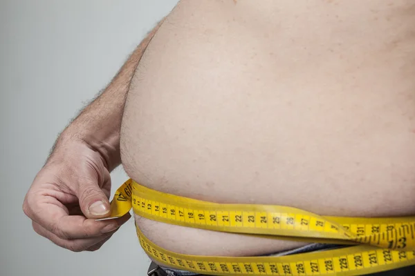 Barriga grande de um homem gordo — Fotografia de Stock