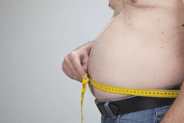 Big belly of a fat man — Stock Photo, Image