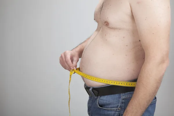 Stora magen på en fet man — Stockfoto