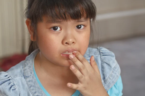 Girl toothache. — Stock Photo, Image