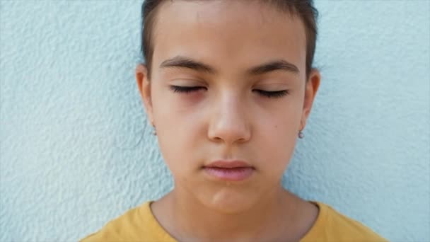 Child Eye Inflamed Selective Focus Kid — Video