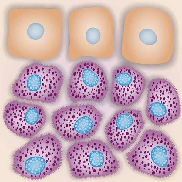 Sistema Inmunitario Innato Mastocitos Con Células Piel Ilustración Vectorial — Archivo Imágenes Vectoriales