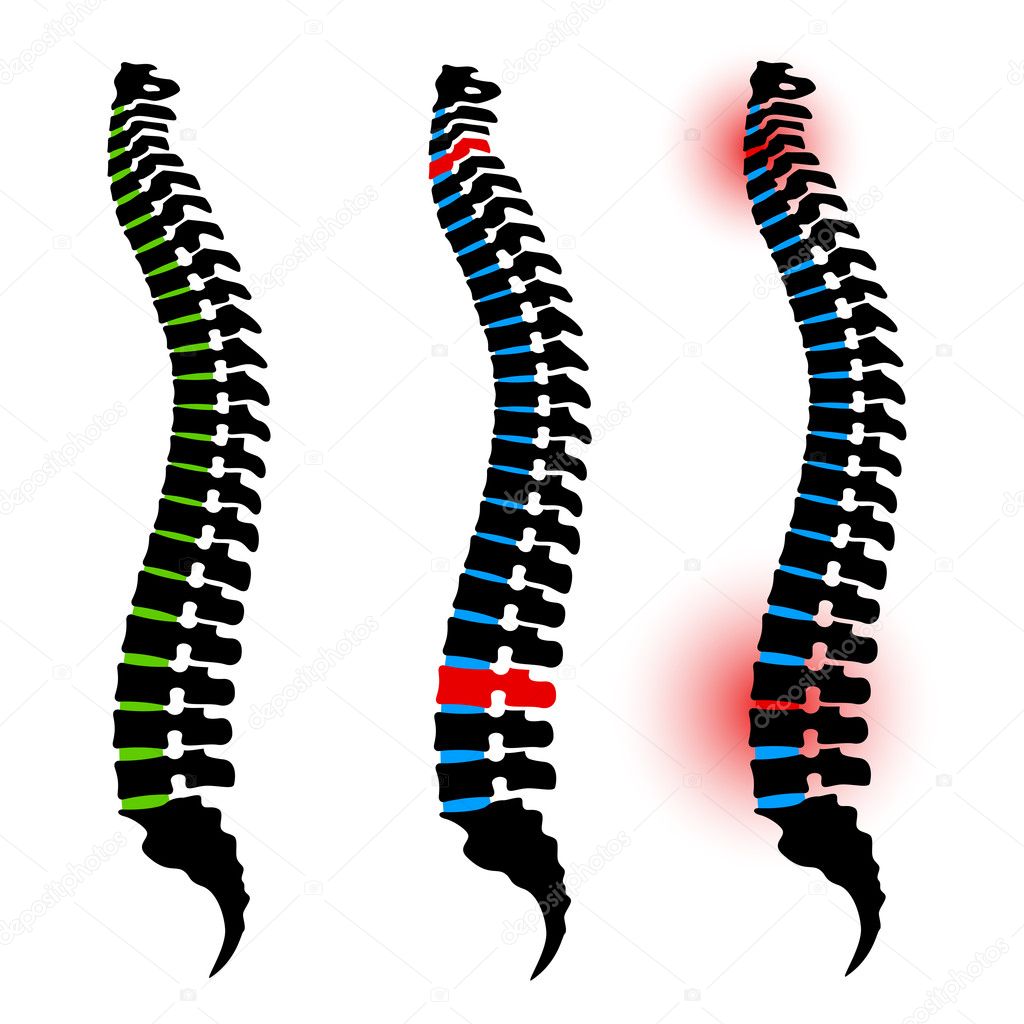 human spine silhouettes