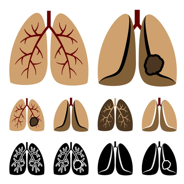 Iconos del cáncer de pulmón humano — Vector de stock