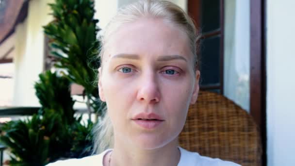 Портрет Уставшей Больной Женщины Голубыми Глазами Смотрящей Камеру Женщины Покраснели — стоковое видео