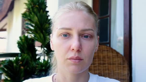 Портрет Уставшей Больной Женщины Голубыми Глазами Смотрящей Камеру Сморкающейся Носовую — стоковое видео