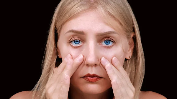 Second chin, obesity. Portrait of a 30-year-old woman pulling back the skin on her cheeks looks into the camera with a frustrated look. Problems of aging and appearance. Facelift, plastic surgery.