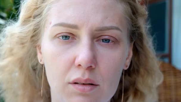 Portretul Unei Femei Bolnave Obosite Ochi Albaştri Privind Camera Femeia — Videoclip de stoc