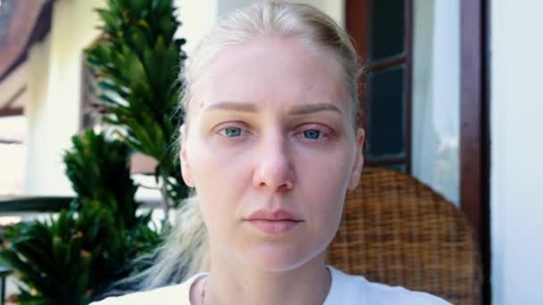 Retrato Una Enferma Cansada Con Ojos Azules Mirando Cámara Mujer — Vídeo de stock