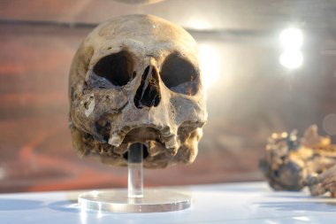 Aksaray / Türkiye - Temmuz 07 2019: İnsan kafatası müzede ortaya çıktı