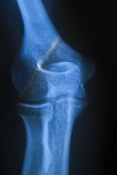 X-Ray Bones in Detail — Stock Photo, Image
