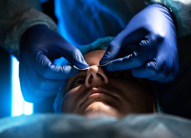 Doktor estetik cerrah burun ve burun estetiğini azaltmak için bir kadın hastayı ameliyat ediyor. Yakın çekim, anatomik