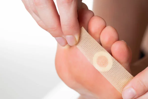 Girl Sticks Medical Plaster Plantar Warts Her Leg Callus Treatment — Stock Photo, Image