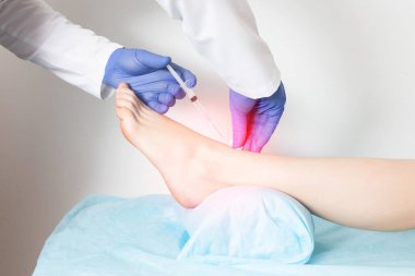 Doktor ortopedist, kıkırdak yenilenmesi ve metabolizma için abluka ilacı enjekte ediyor. İltihap önleyici