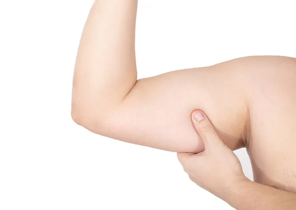 Humant Forarm Biceps Hvit Bakgrunn Isoler Muskelamyotrofi Konsept Rehabilitering Ved – stockfoto