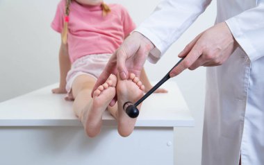 Bir doktor, bir nörolog, ayağının tabanındaki Babinsky refleksini kontrol eder. Nörolojik çekiç