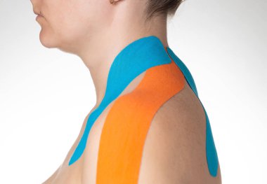 Kızın omzunda mavi ve turuncu kineziyolojik bantla kas ve bağ dokusu sabitleme, yakın plan. Spor ve metabolizmada kayıt