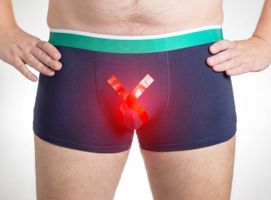 Kızıl haçlı şortlu bir adam. Erkek üreme sistemi, hidrocele ve varicocele hastalıkları kavramı. Androloji