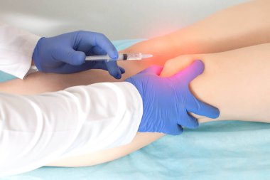 Doktor trombosit zengini plazma enjeksiyonu yapar, eklemlerin yenilenme sürecinde otomatik uyarılma, yakın çekim...