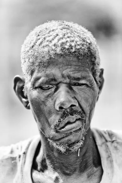 Een man uit togo met de vernietigde gezicht — Stockfoto