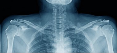 İnsan vücudunun üst kısmının x-ray görüntüsü 