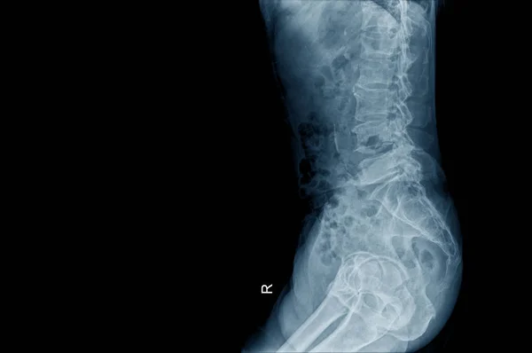 lateral view of human structure in blue ton