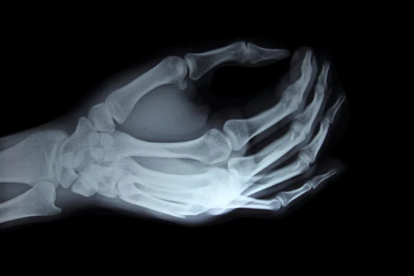 X-Ray hand — Stockfoto