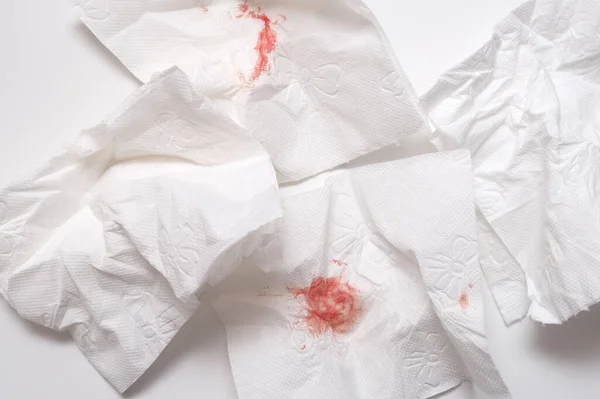 Χρησιμοποιημένα φύλλα ματωμένου χαρτιού υγείας σε λευκό φόντο κοντά, αιμορροΐδες και πρωκτική αιμορραγία έννοια — Φωτογραφία Αρχείου