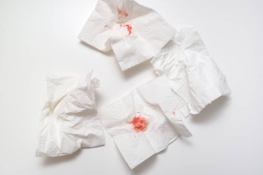 Beyaz arka planda kullanılmış tuvalet kağıdındaki kan, anal kanama ve hemoroit konsepti