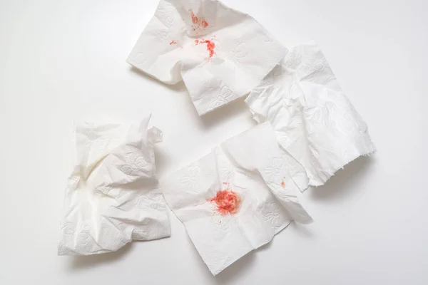 Αίμα σε χρησιμοποιημένο χαρτί υγείας σε λευκό φόντο, πρωκτική αιμορραγία και αιμορροΐδης έννοια — Φωτογραφία Αρχείου