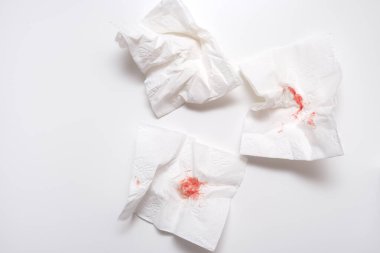Beyaz arka planda kullanılmış tuvalet kağıdındaki kan, anal kanama ve hemoroit konsepti