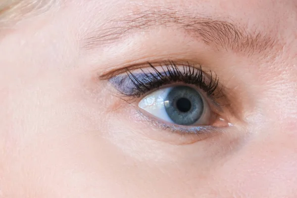 Twarz kobiety, zmarszczki oczu po zabiegu - efekt odmładzania zabiegów kosmetologicznych biorewitalizacji, liftingu twarzy i usuwania plamek pigmentowych — Zdjęcie stockowe