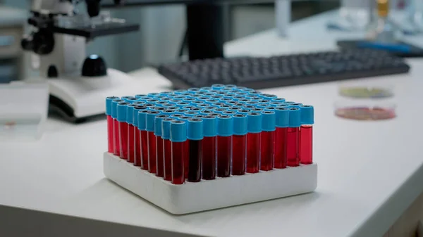 Primo piano dei vacutainer con sangue liquido in laboratorio — Foto Stock